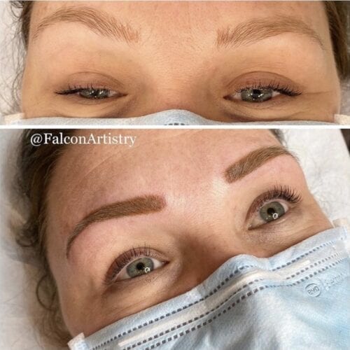 Brows Revision