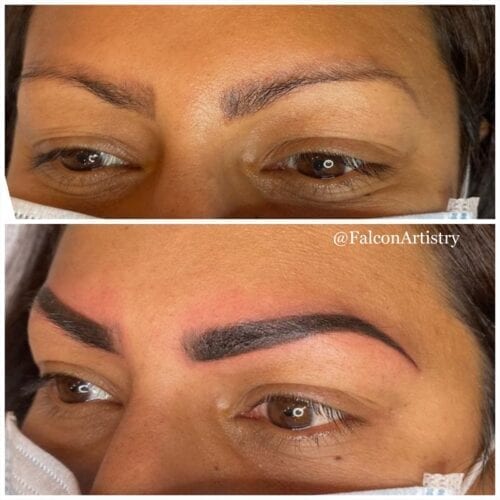 Brows Revision